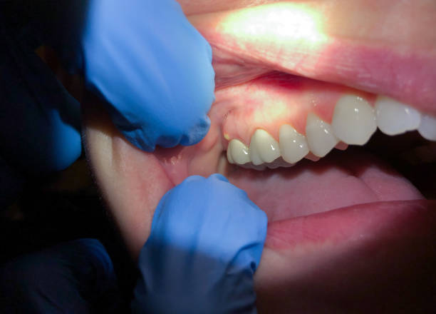 Reliable OK Emergency Dental Service Solutions