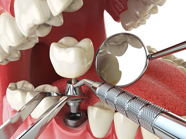Best Emergency Denture Repair in Duncan, OK